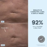 NuBODY®Microcurrent Skin Toning Device for Body - Image 3