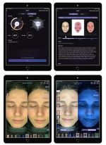 acne analyzer pro (ai skin scanner) - Image 5