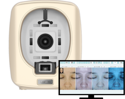 line-vu led facial skin analyzer